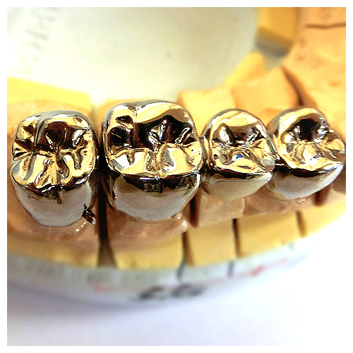 �u���b�W�@�T���v��